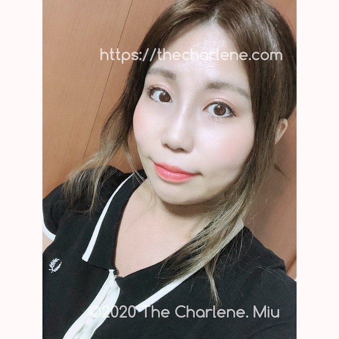 ビフォーアフター 狭いおでこを広くするならおでこ脱毛で整形 医療レーザー脱毛の体験談ブログ The Charlene シャーレイン Miu ブログ