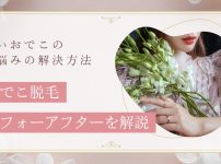 おでこ脱毛のビフォーアフターを徹底解説